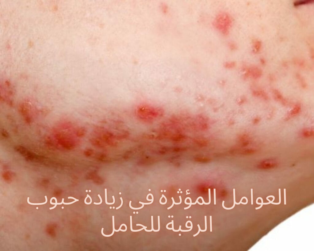 حبوب في الرقبة للحامل