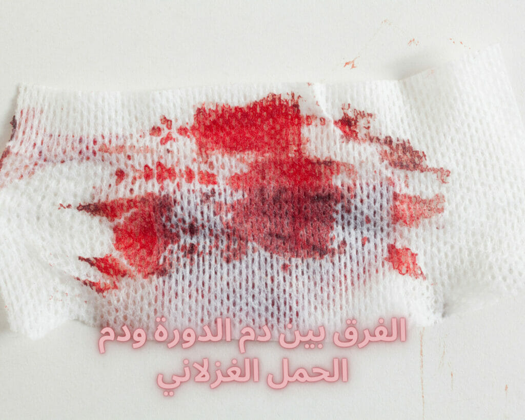 الفرق بين دم الدورة ودم الحمل الغزلاني