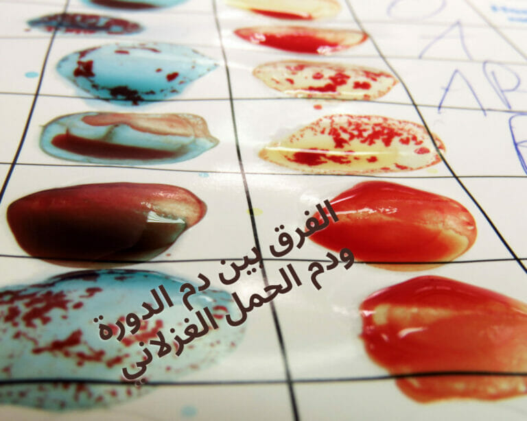 الفرق بين دم الدورة ودم الحمل الغزلاني