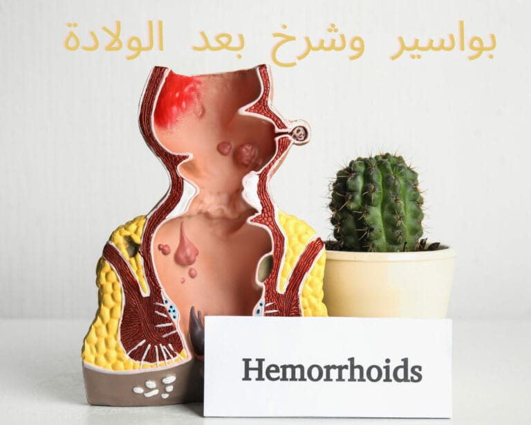 بواسير وشرخ بعد الولادة
