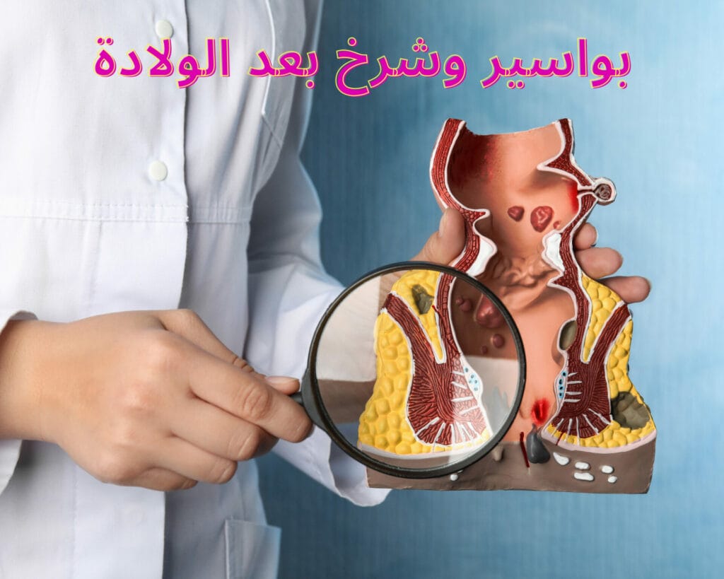 بواسير وشرخ بعد الولادة