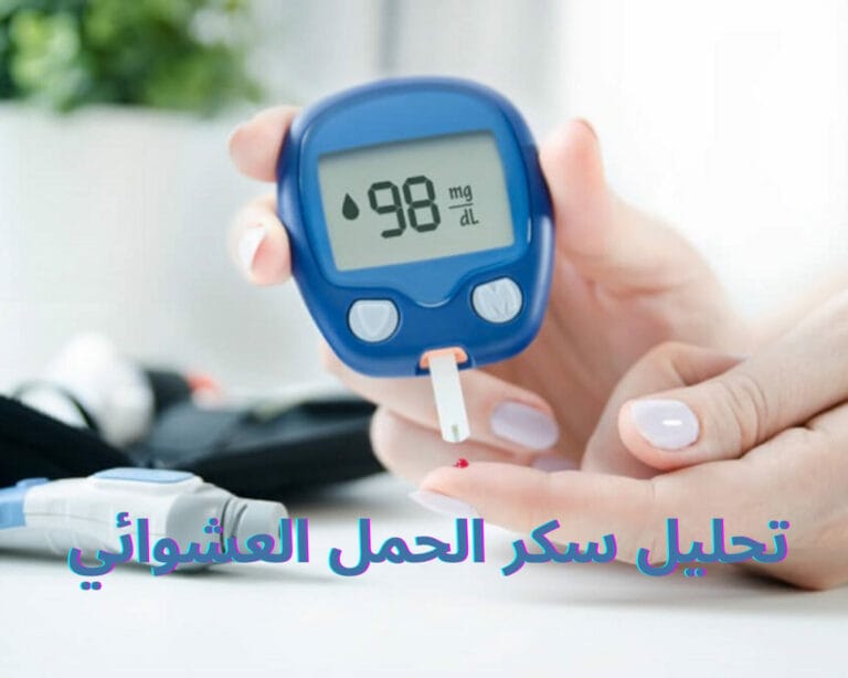 تحليل سكر الحمل العشوائي