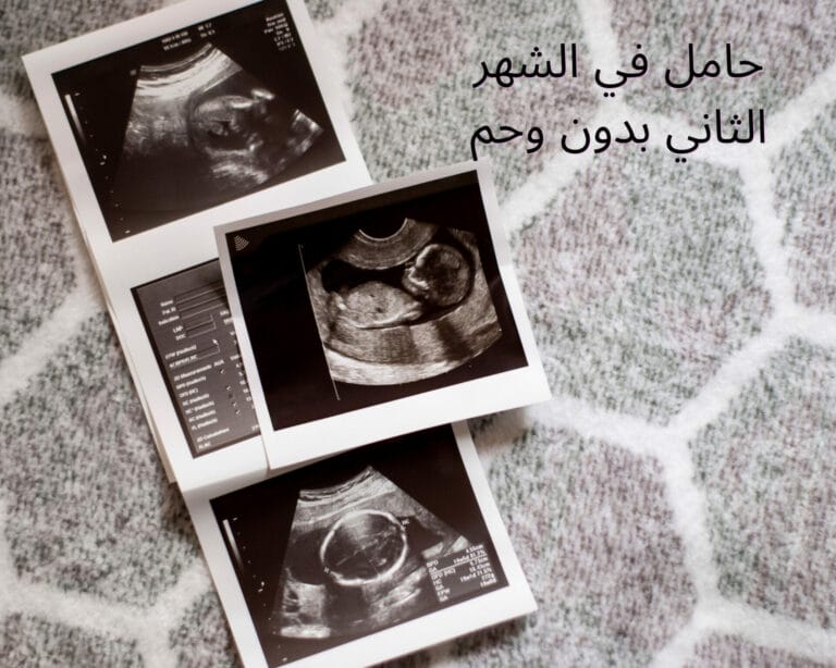 حامل في الشهر الثاني بدون وحم