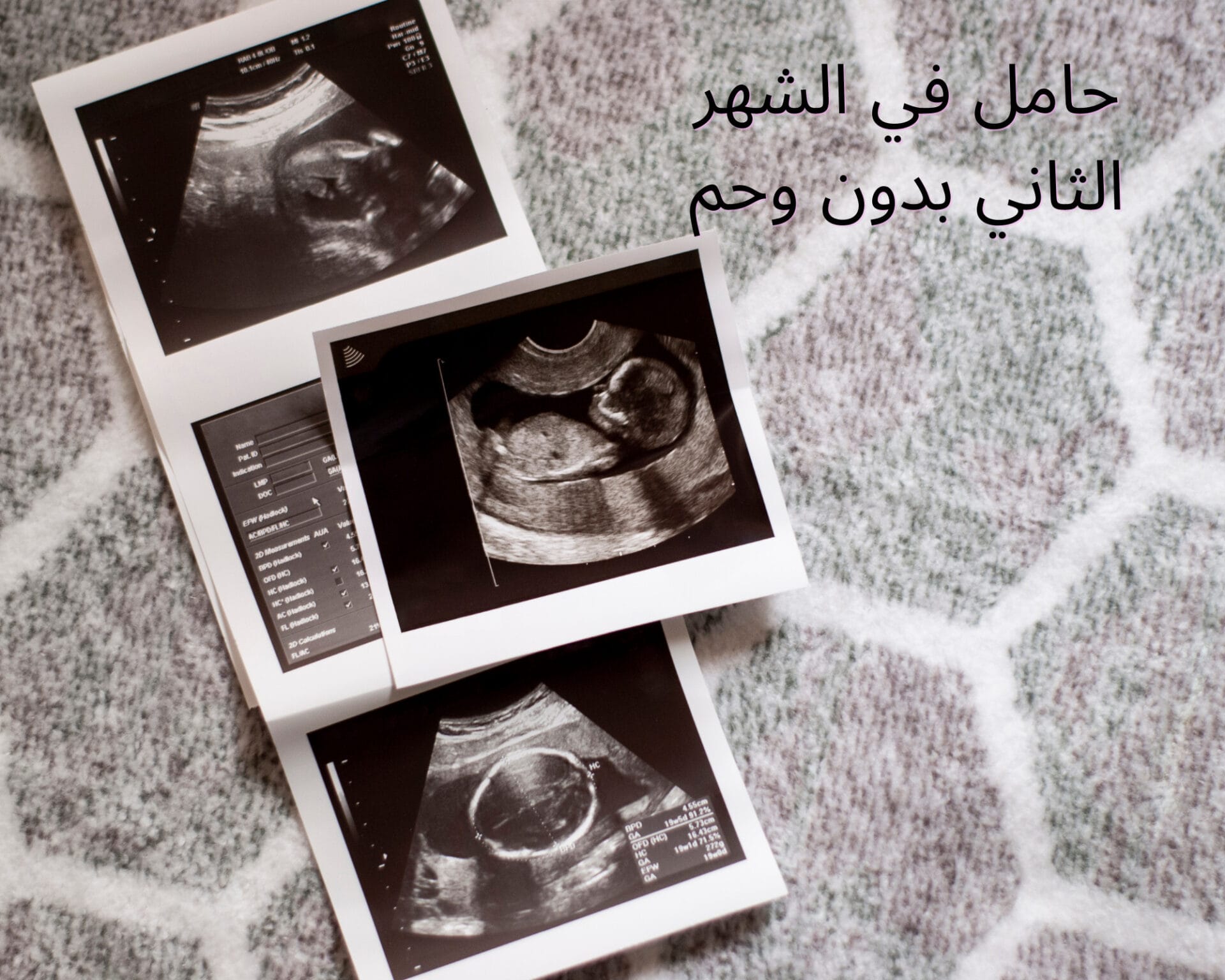 حامل في الشهر الثاني بدون وحم
