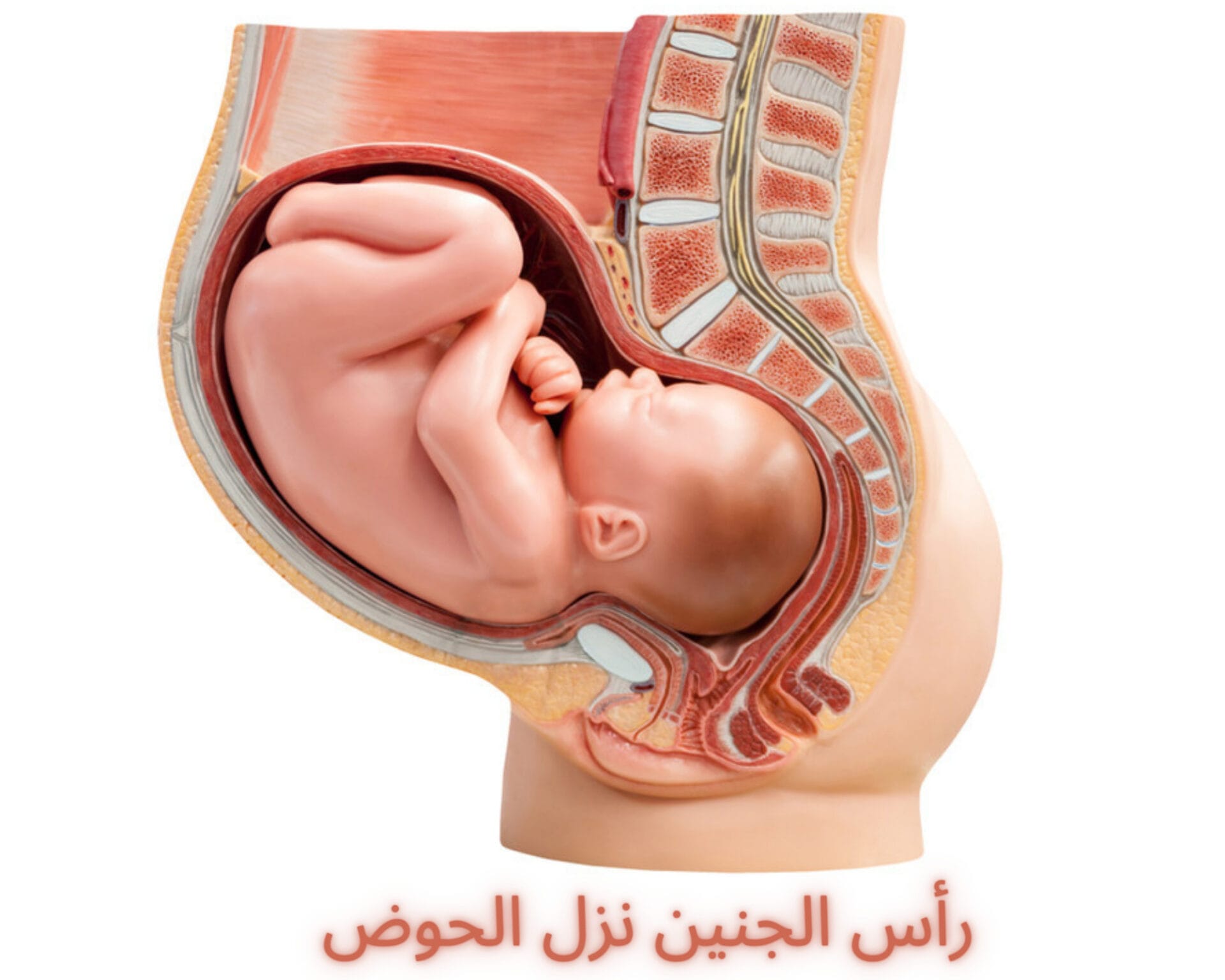 رأس الجنين نزل الحوض