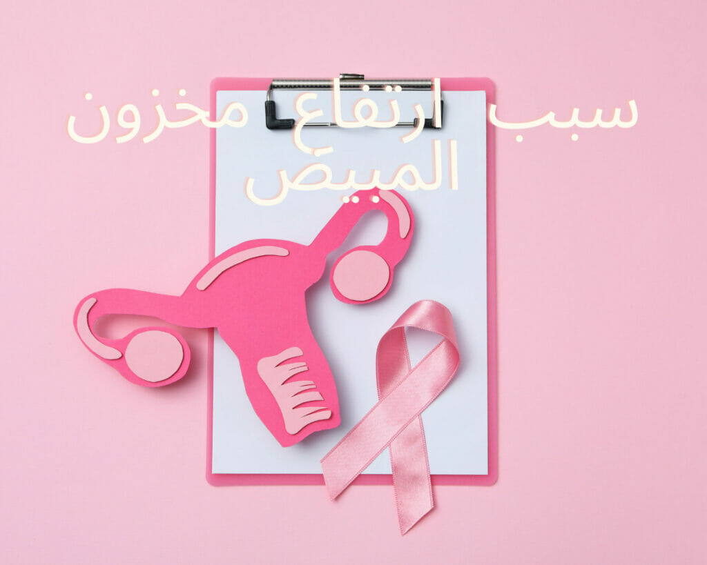 التكيسات ومخزون المبايض