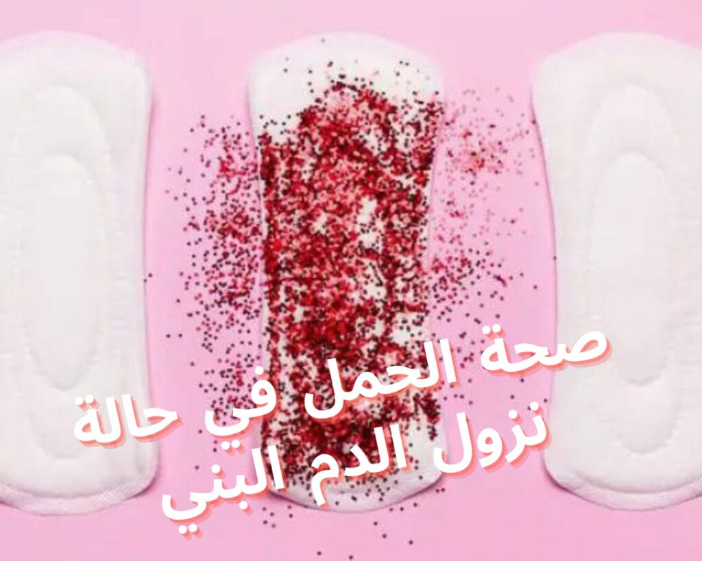 ما سبب نزول دم بني في الاسبوع السادس من الحمل