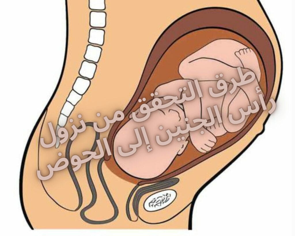 طرق التحقق من نزول رأس الجنين إلى الحوض