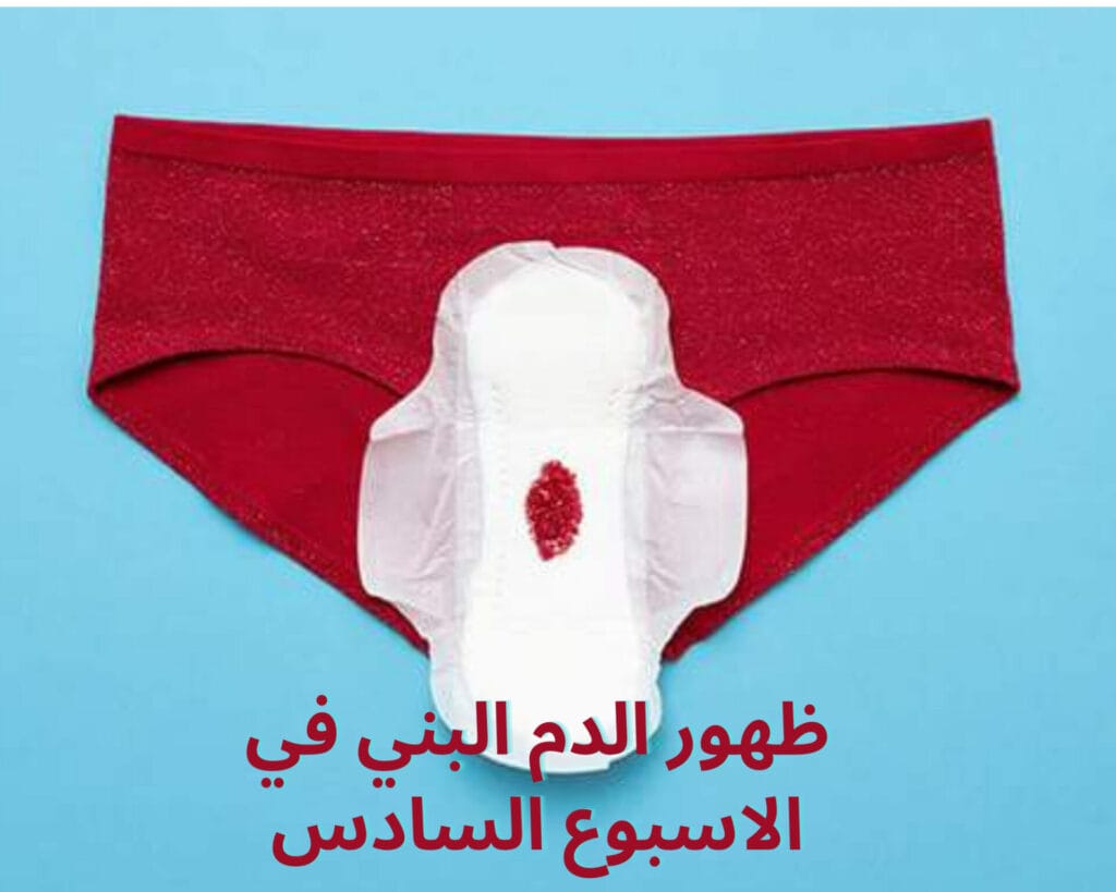 ظهور الدم البني في الاسبوع السادس