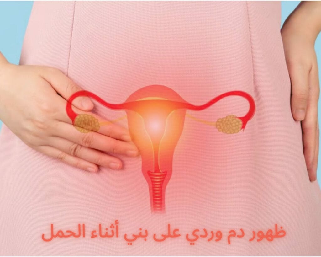 دم وردي على بني