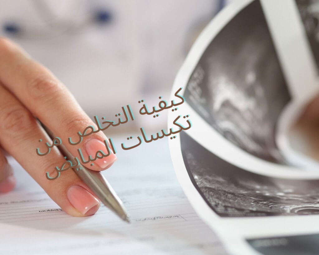 تجربتي مع تكيسات المبايض