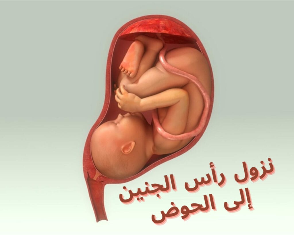 نزول رأس الجنين إلى الحوض