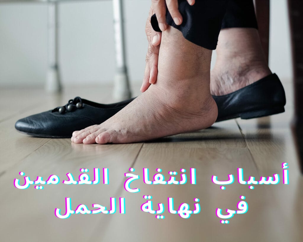 انتفاخ القدمين اخر الحمل