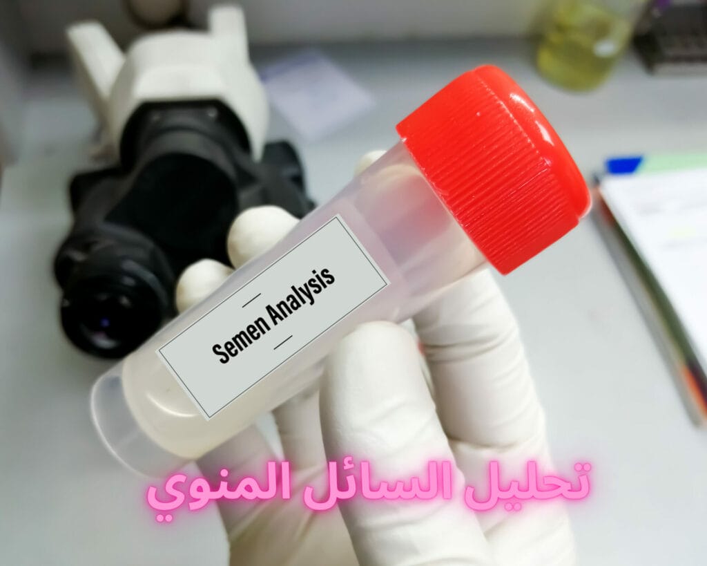 ما هي تحاليل تأخر الحمل