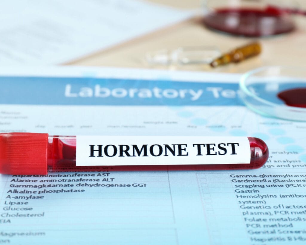 ما هي تحاليل تأخر الحمل