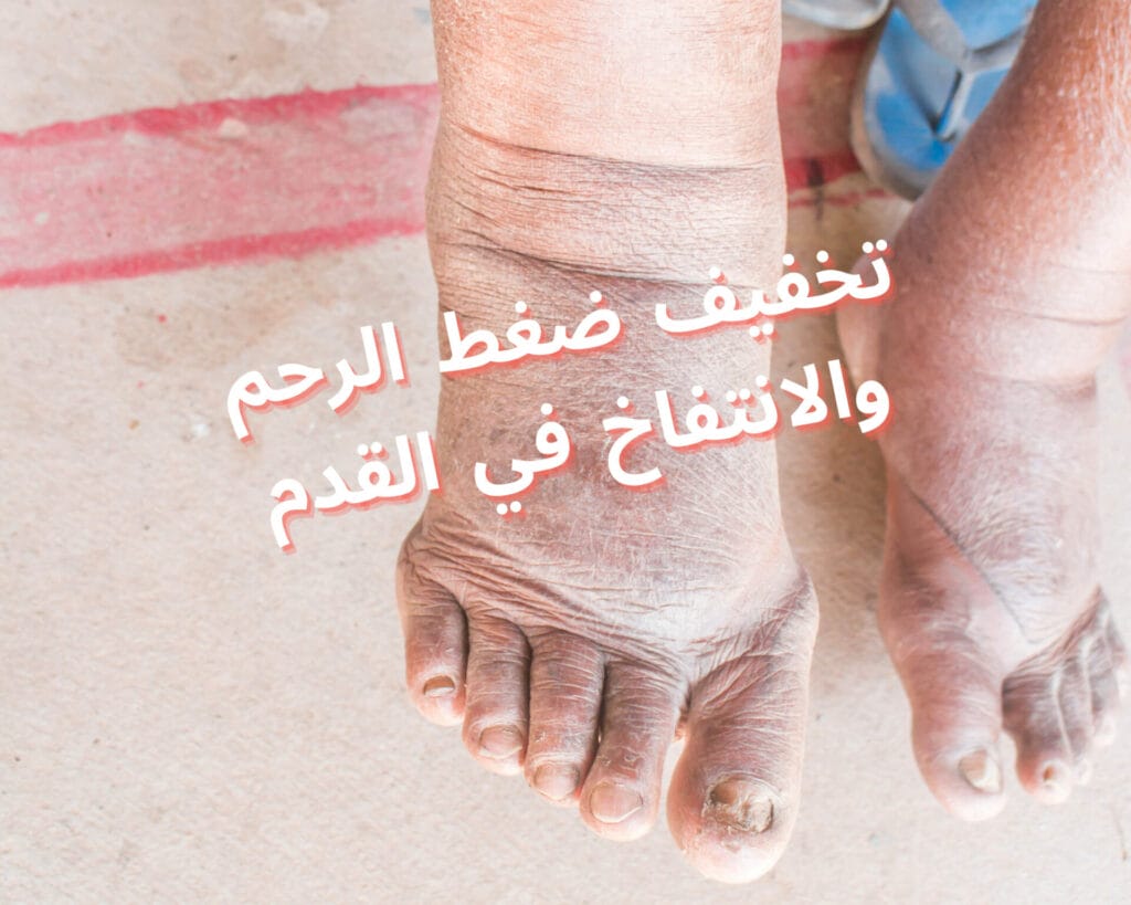 سبب انتفاخ القدم بعد الولادة