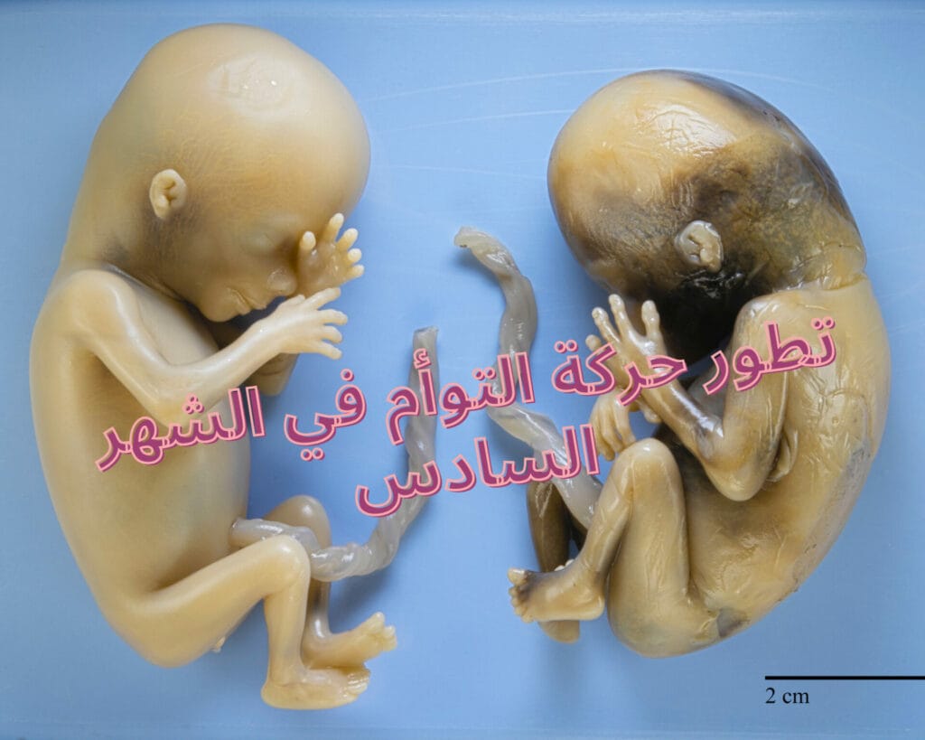 حركة التوأم في الشهر السادس