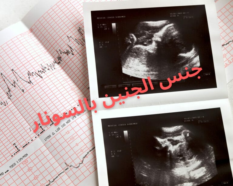 جنس الجنين بالسونار