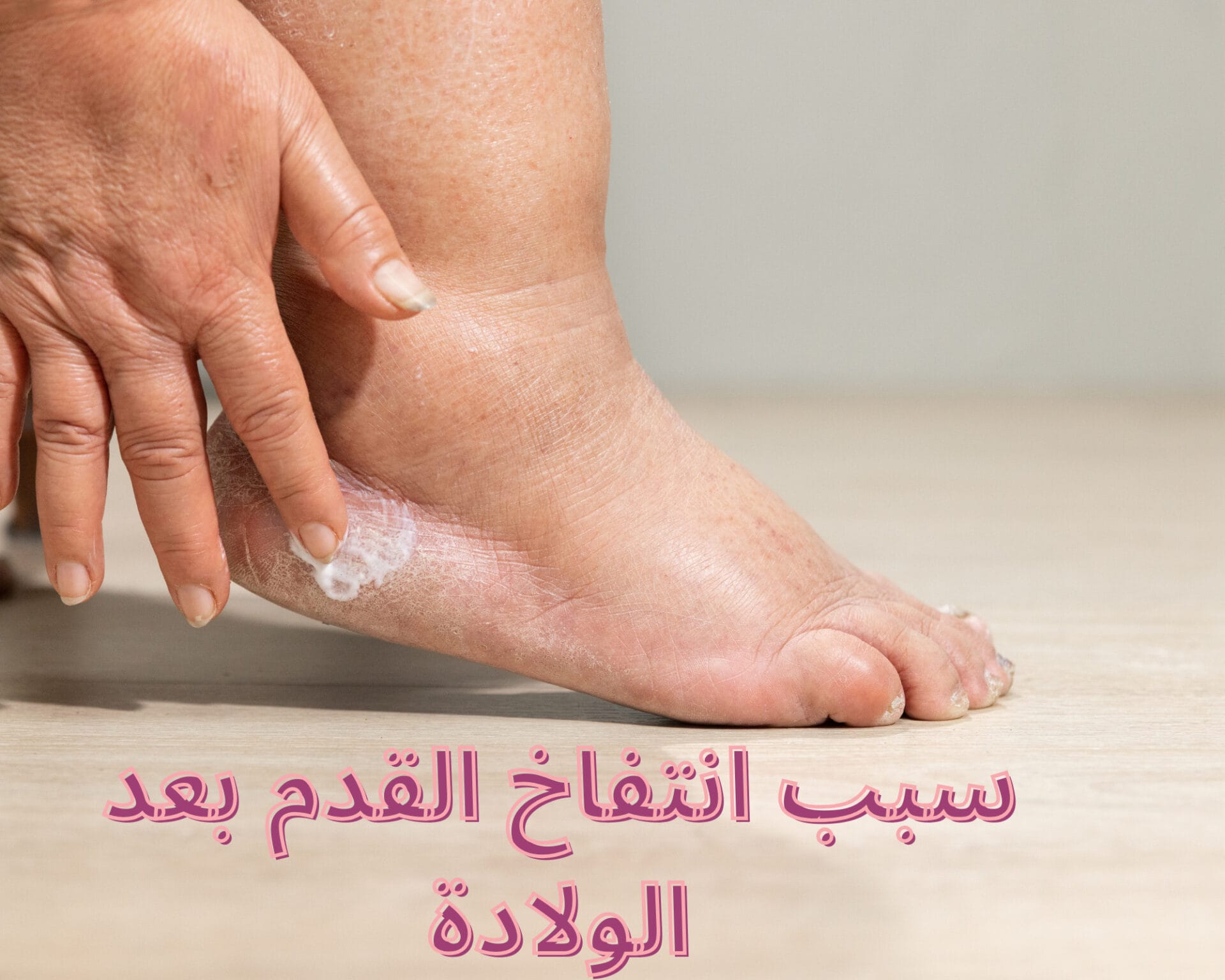 سبب انتفاخ القدم بعد الولادة