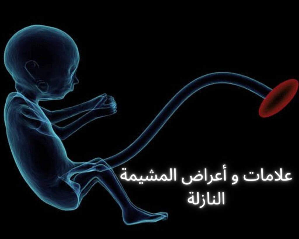 المشيمة النازلة متى ترتفع