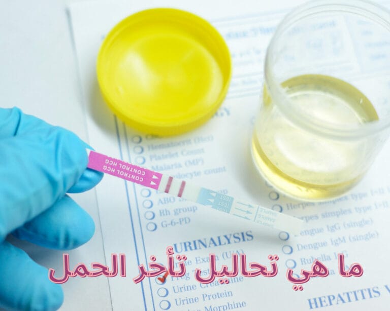 ما هي تحاليل تأخر الحمل