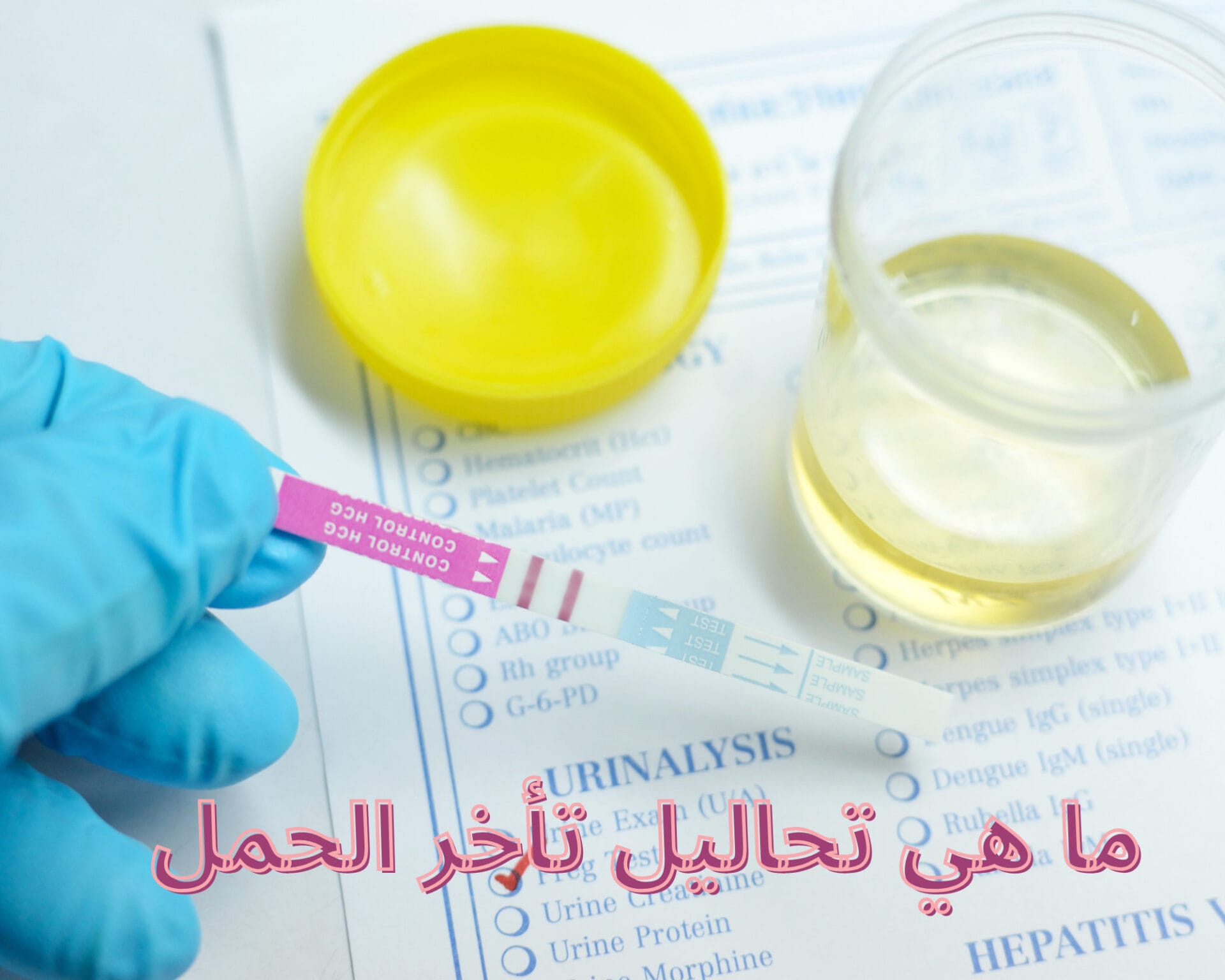 ما هي تحاليل تأخر الحمل