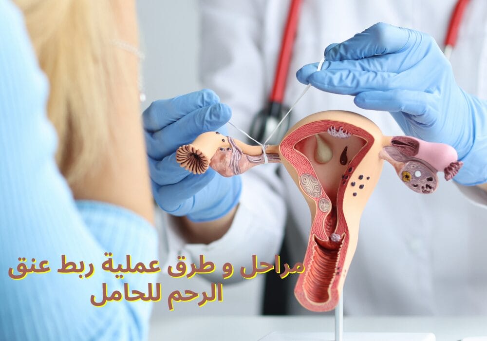 ربط عنق الرحم للحامل