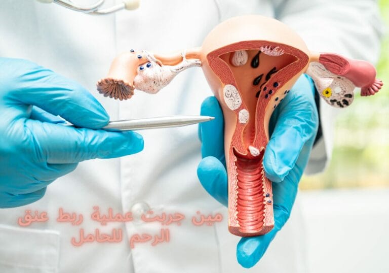 مين جربت عملية ربط عنق الرحم للحامل