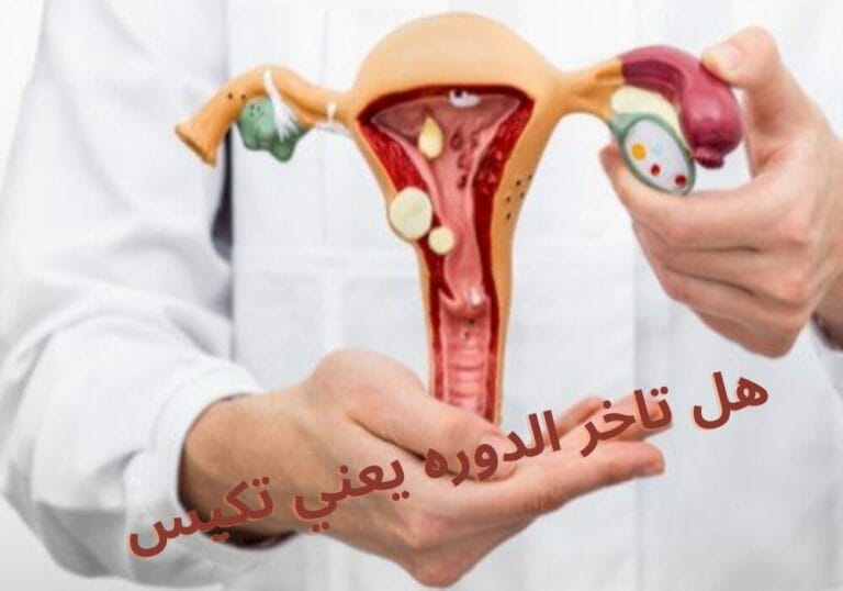 هل تاخر الدوره يعني تكيس
