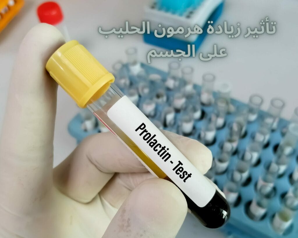 هرمون الحليب عندي 20