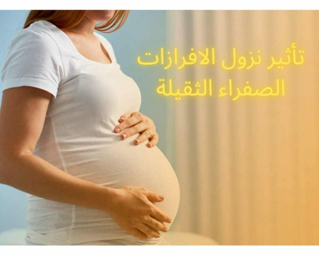 نزول افرازات صفراء