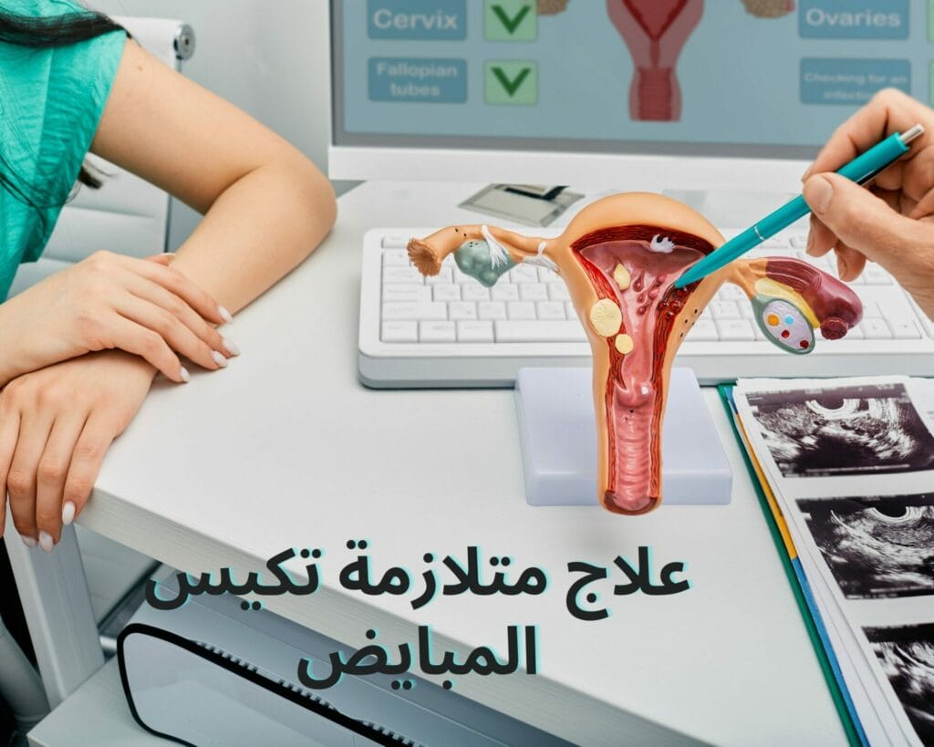 متلازمة تكيس المبايض واخذت كلوميد
