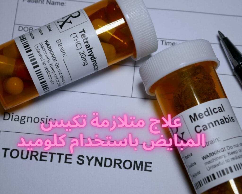 متلازمة تكيس المبايض واخذت كلوميد