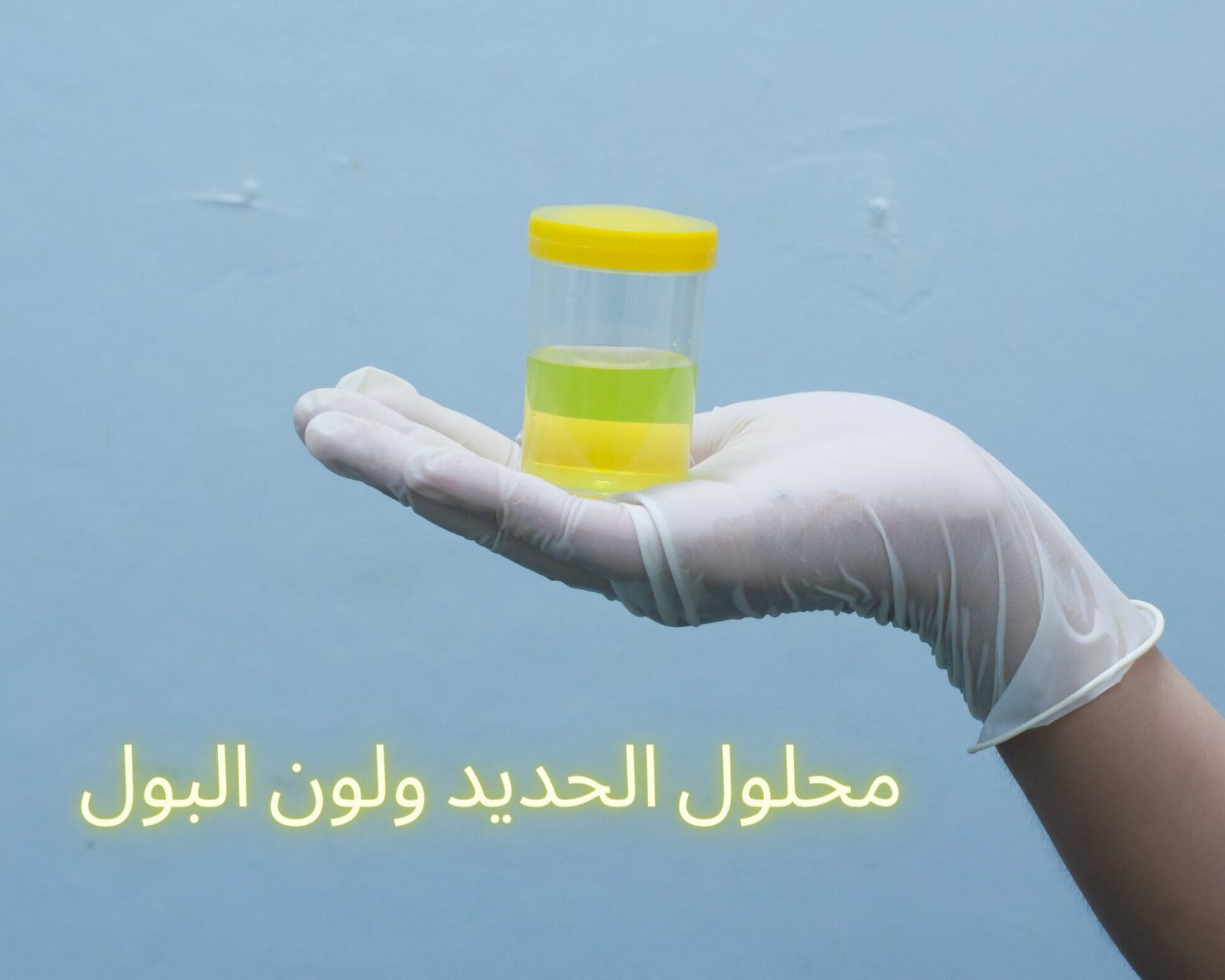 محلول الحديد ولون البول