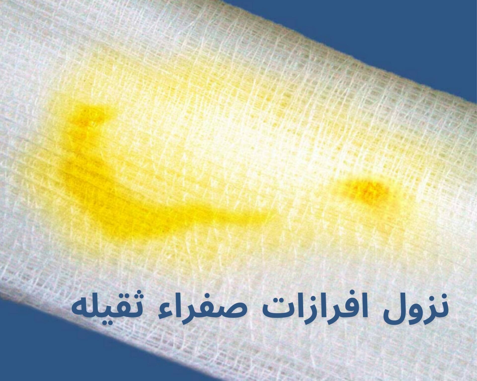 نزول افرازات صفراء ثقيله