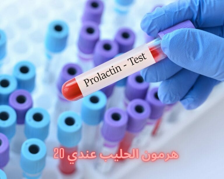 هرمون الحليب عندي 20