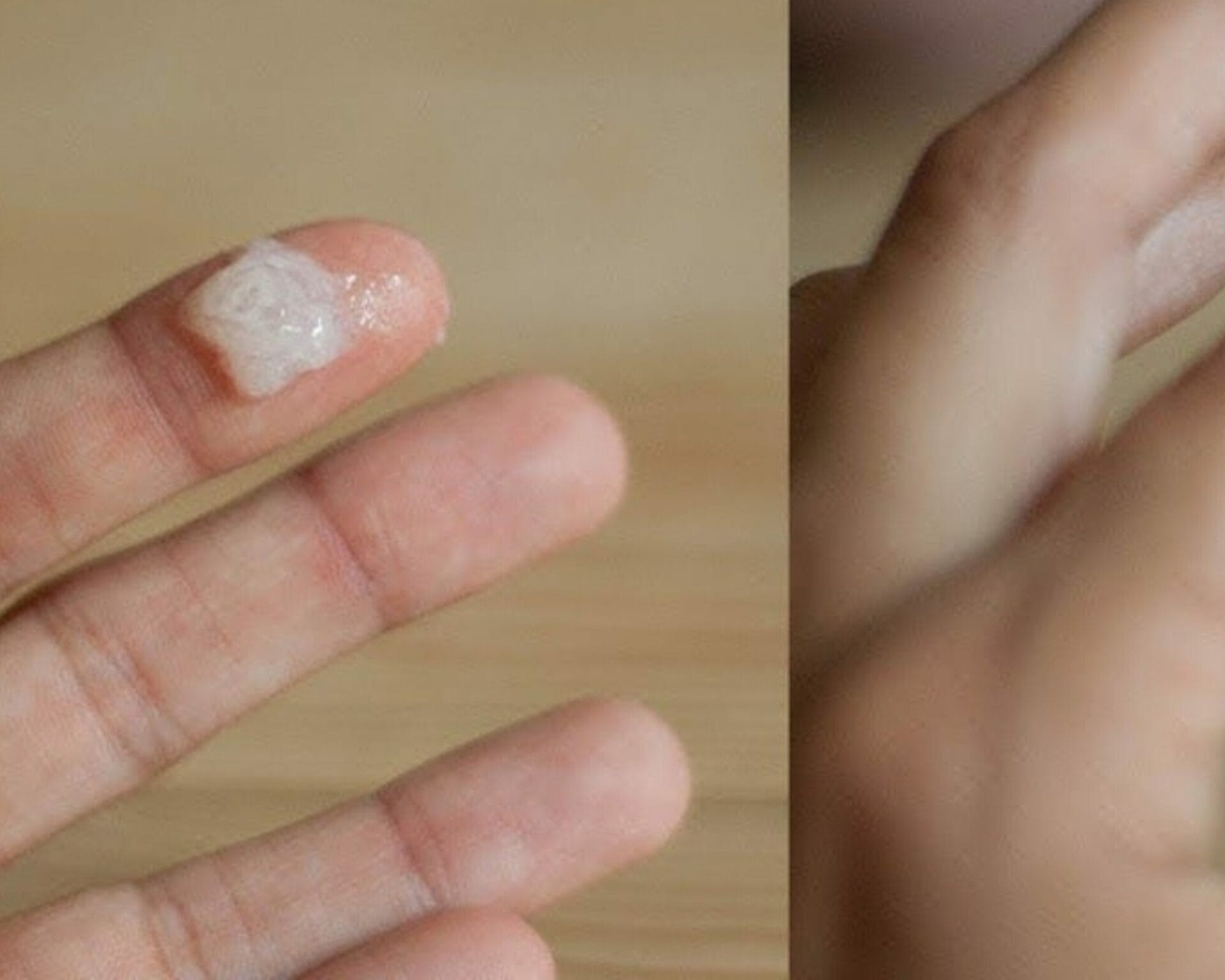 الافرازات الشفافة خلال فترة الحمل