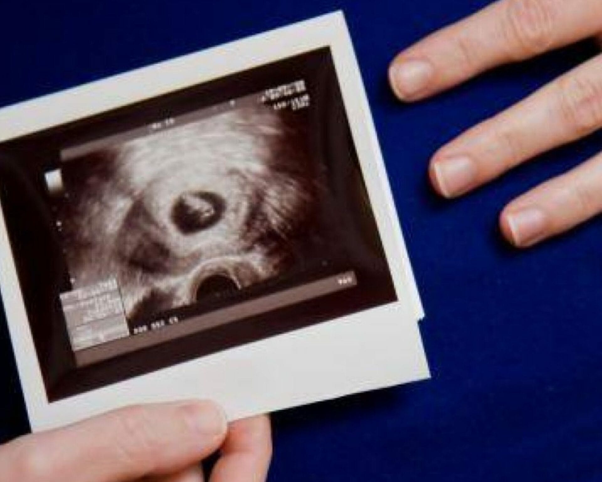 اسباب الحمل بكيس فاضي