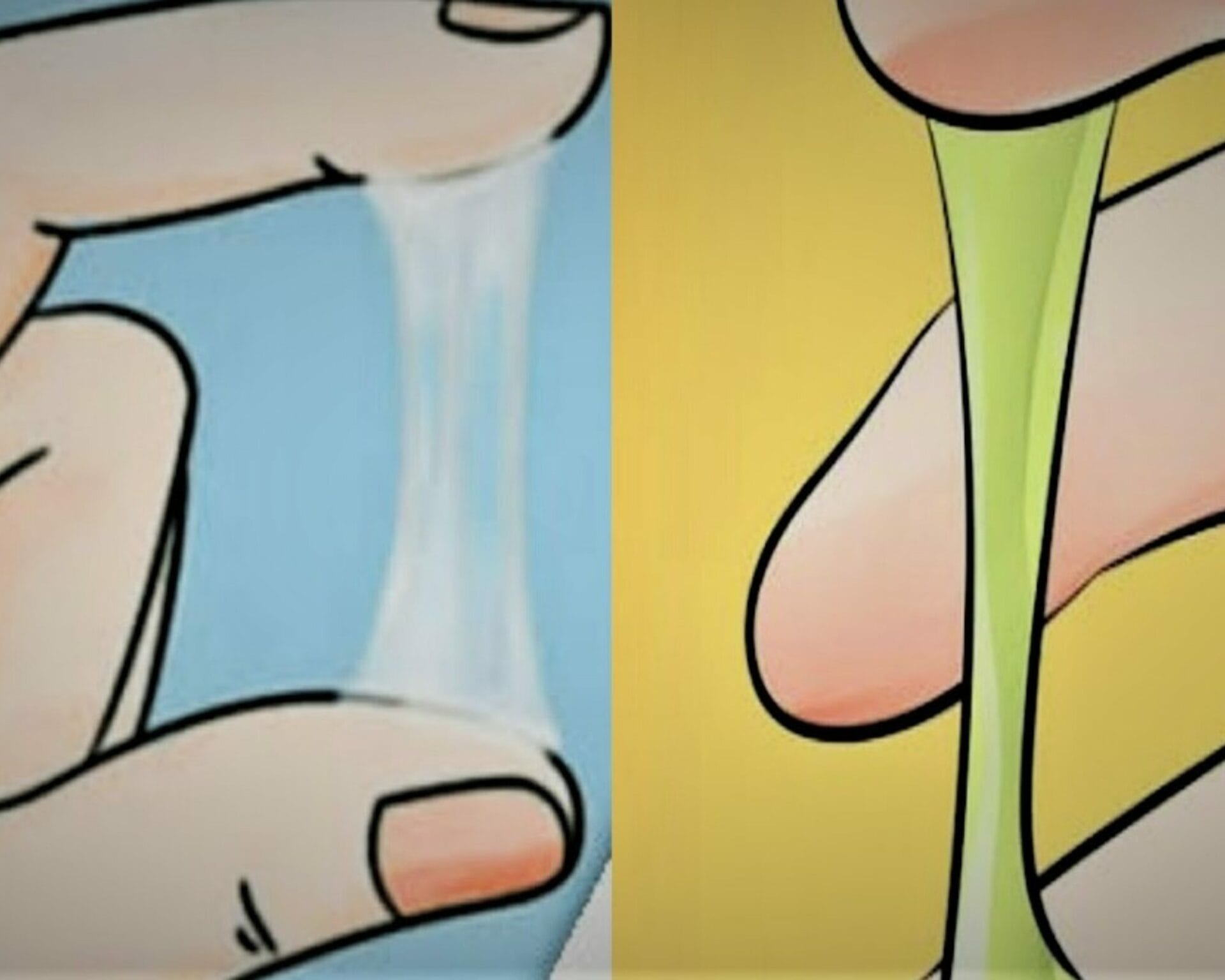 الافرازات الشفافة خلال فترة الحمل