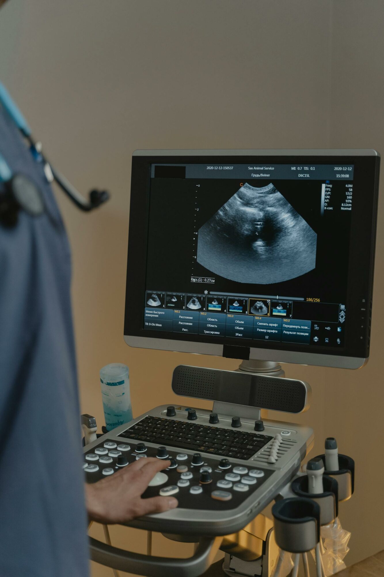 A healthcare professional using aاشعة رباعية الابعاد على الرحمn ultrasound machine in a clinical setting.