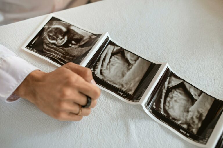 مين الدكتور قالها نوع الجنين وطلع غلط